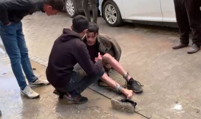 Şanlıurfa'da tinerle ısınmak isteyen bir kişi yaralandı