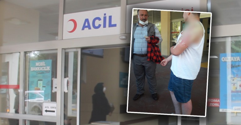 Üzerine kaynar su döküldü