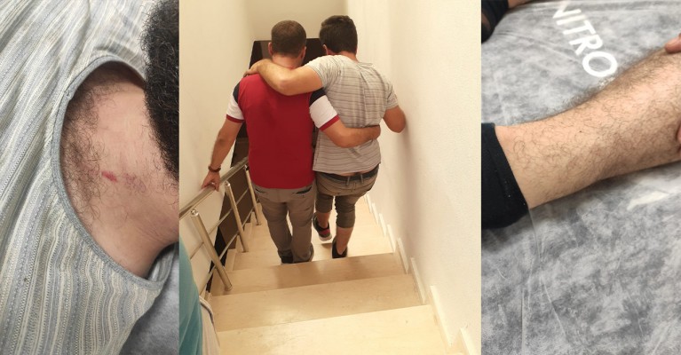 Polis kapısını yanlışlıkla çalan bilişimciyi darp etti