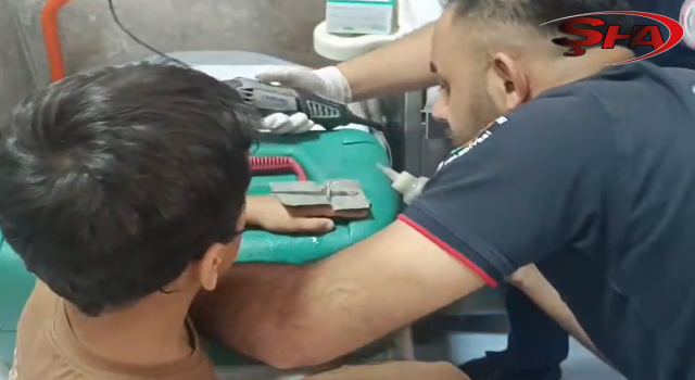 Şanlıurfa'da bir çocuğun parmağı cıvata puluna sıkıştı