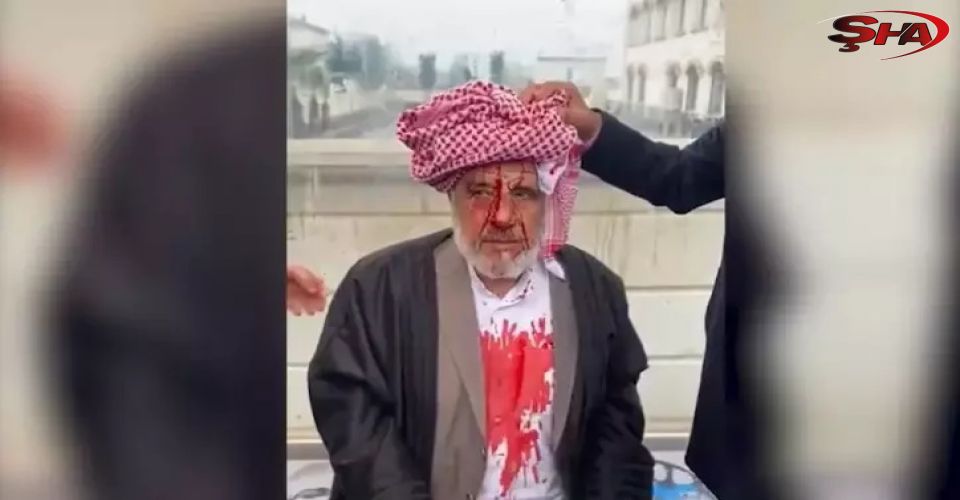 Viranşehir’de Sopalı Saldırı: 4 Kişi Tutuklandı