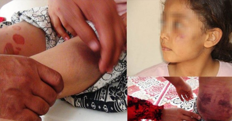 Şanlıurfa’da eşi ve çocuklarına işkence eden baba, tutuksuz olarak yargılanacak