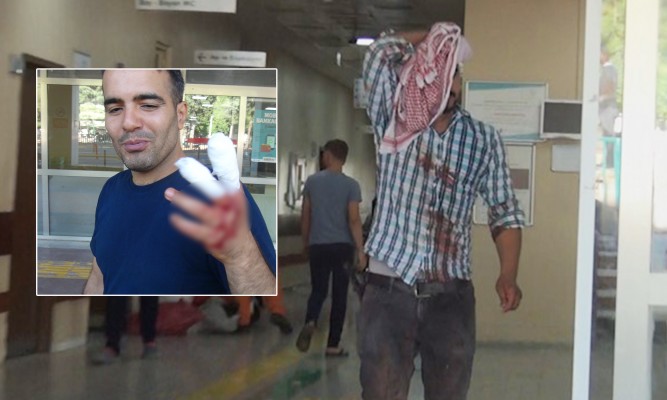 Şanlıurfa’da acemi kasaplar hastanelik oldu