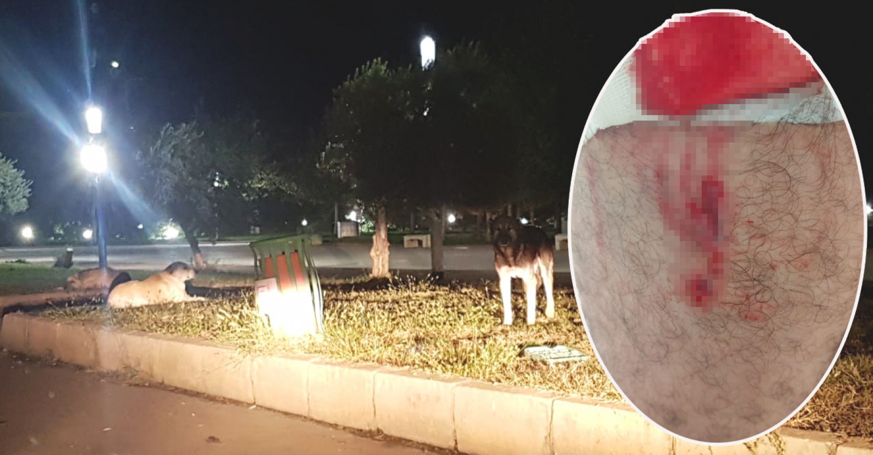 Şanlıurfa'da 3 kişi köpeklerin saldırısına uğradı